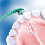 Philips Sonicare HX8012/07 Beccucci per Sistema di Pulizia Interdentale AirFloss, 2 Beccucci inclusi - immagine 6